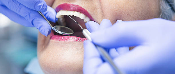 Best Emergency Treatment for Toothache in Berkeley, MO